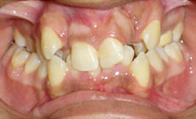 Comprehensive Orthodontics