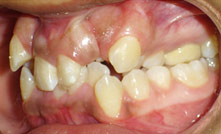 Comprehensive Orthodontics