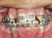 Comprehensive Orthodontics