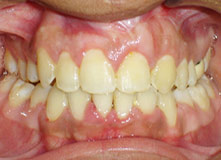 Comprehensive Orthodontics