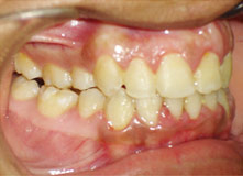 Comprehensive Orthodontics